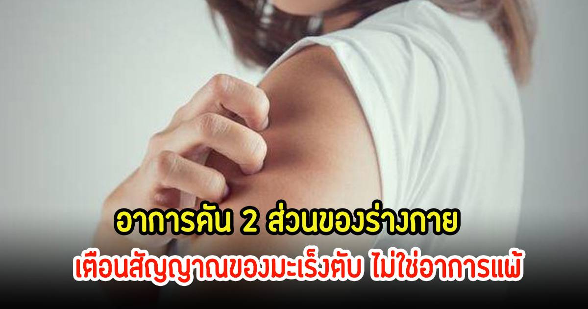ควรระวัง! ร่างกายมีอาการคัน 2 ส่วนนี้ อาจเป็นสัญญาณของ “มะเร็งตับ” ไม่ใช่อาการแพ้