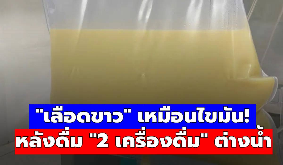 ช็อก! ชายวัย 29 เลือดเป็นสีขาวข้น เหมือน “ไขมัน” หลังดื่ม “2 เครื่องดื่มนี้” ต่างน้ำ 6 เดือน หวิดดับ