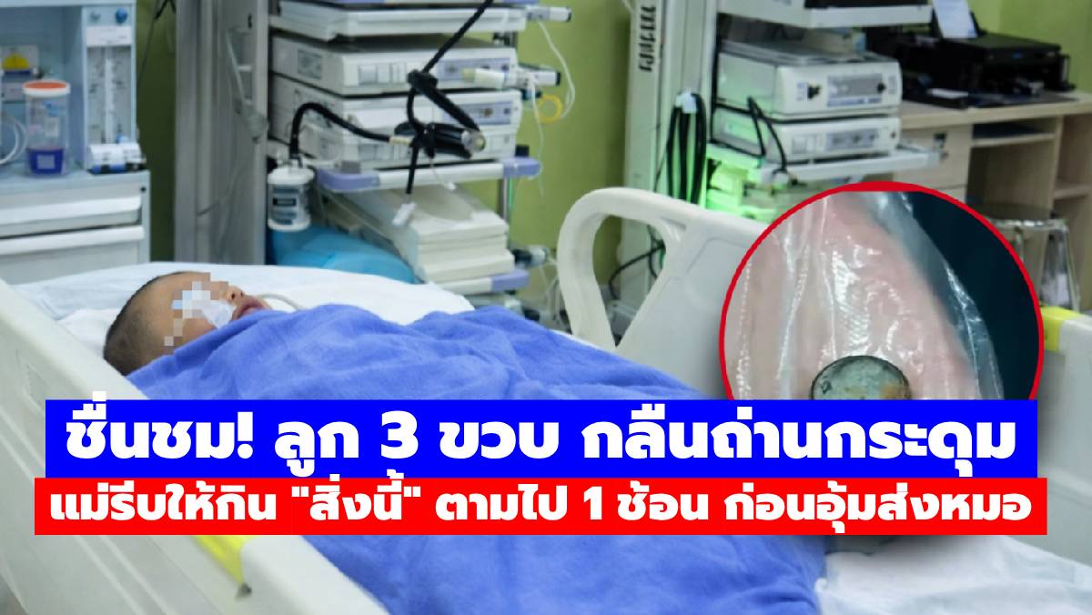 ชื่นชม! ลูก 3 ขวบ กลืนถ่านกระดุม แม่รีบให้กิน “สิ่งนี้” ตามไป 1 ช้อน ก่อนอุ้มส่งหมอ