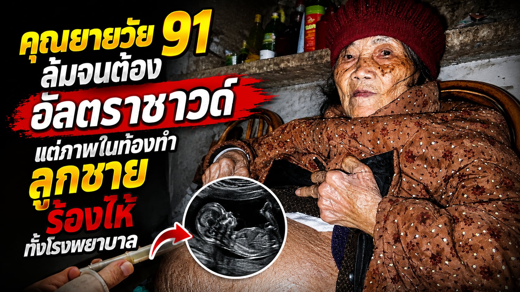คุณยายวัย 91 ล้มจนต้องอัลตราซาวด์ แต่ภาพในท้องทำลูกชายร้องไห้ทั้งโรงพยาบาล