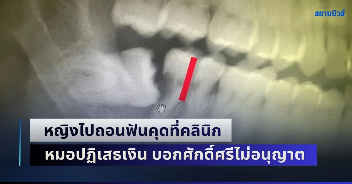 หญิงสุดงง! ไปถอนฟันคุดที่คลินิก ใช้เวลานานกว่า 3 ชม. สุดท้ายไม่ได้ถอน ซ้ำหมอปฏิเสธเงิน บอกศักดิ์ศรีไม่อนุญาต