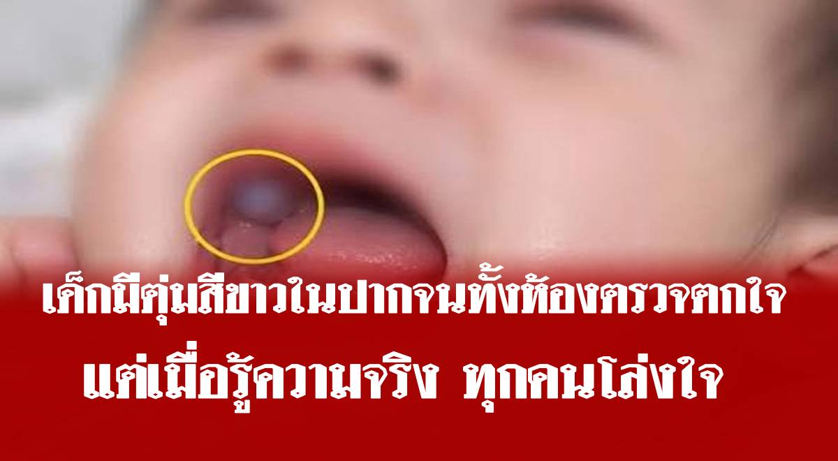 เด็กมีตุ่มสีขาวในปากจนทั้งห้องตรวจตกใจ แต่เมื่อรู้ความจริง ทุกคนโล่งใจ