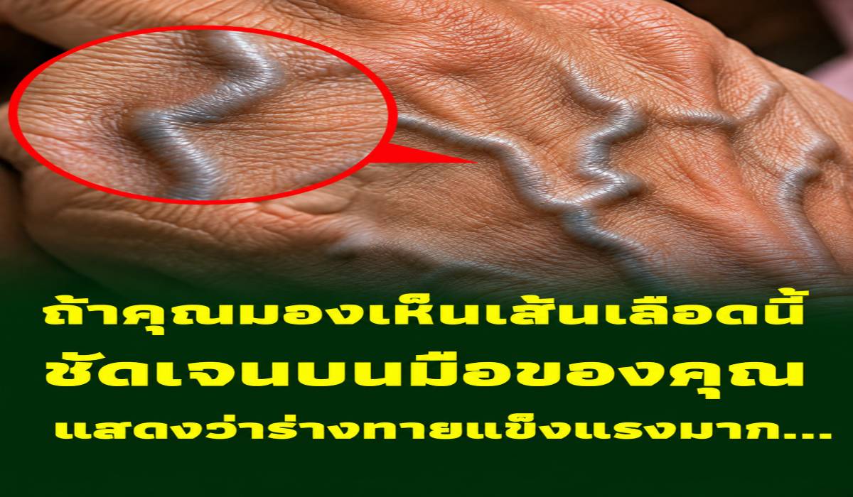 เส้นเลือดบนหลังมือเห็นชัด บอกอะไรเกี่ยวกับสุขภาพได้บ้าง? ทำความเข้าใจ 5 เรื่องสำคัญ
